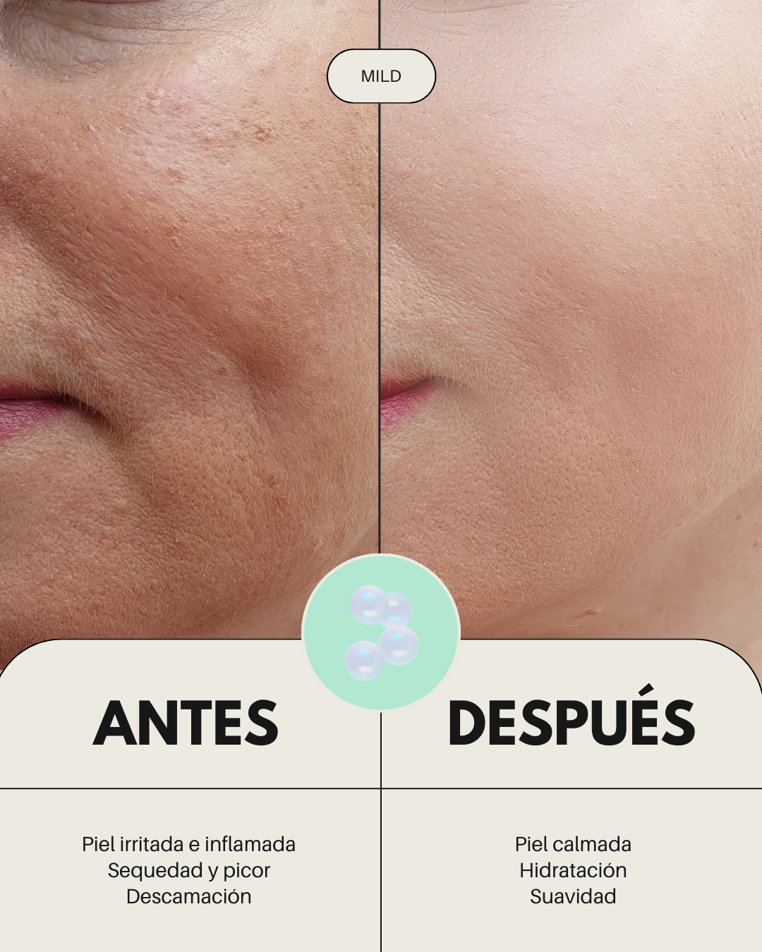 Pack Rutina Facial BÁSICA ECO - PIEL SENSIBLE